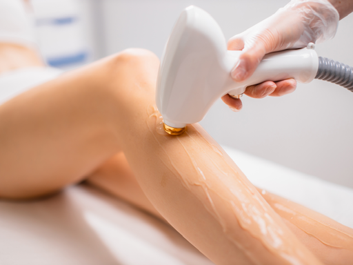Laser Hair Removal in NYC