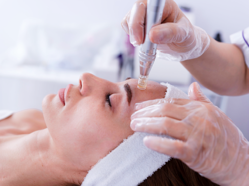 Microneedling